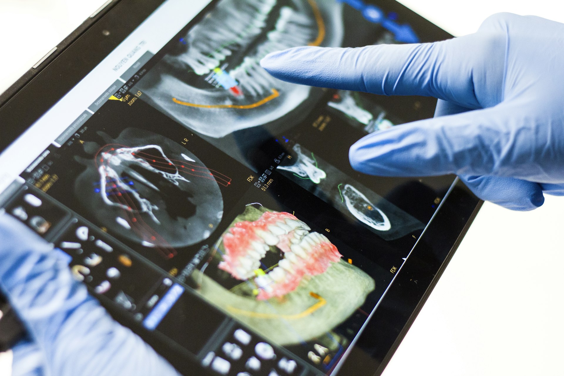 Emerging Technologies Reshaping the Future of Sports Medicine