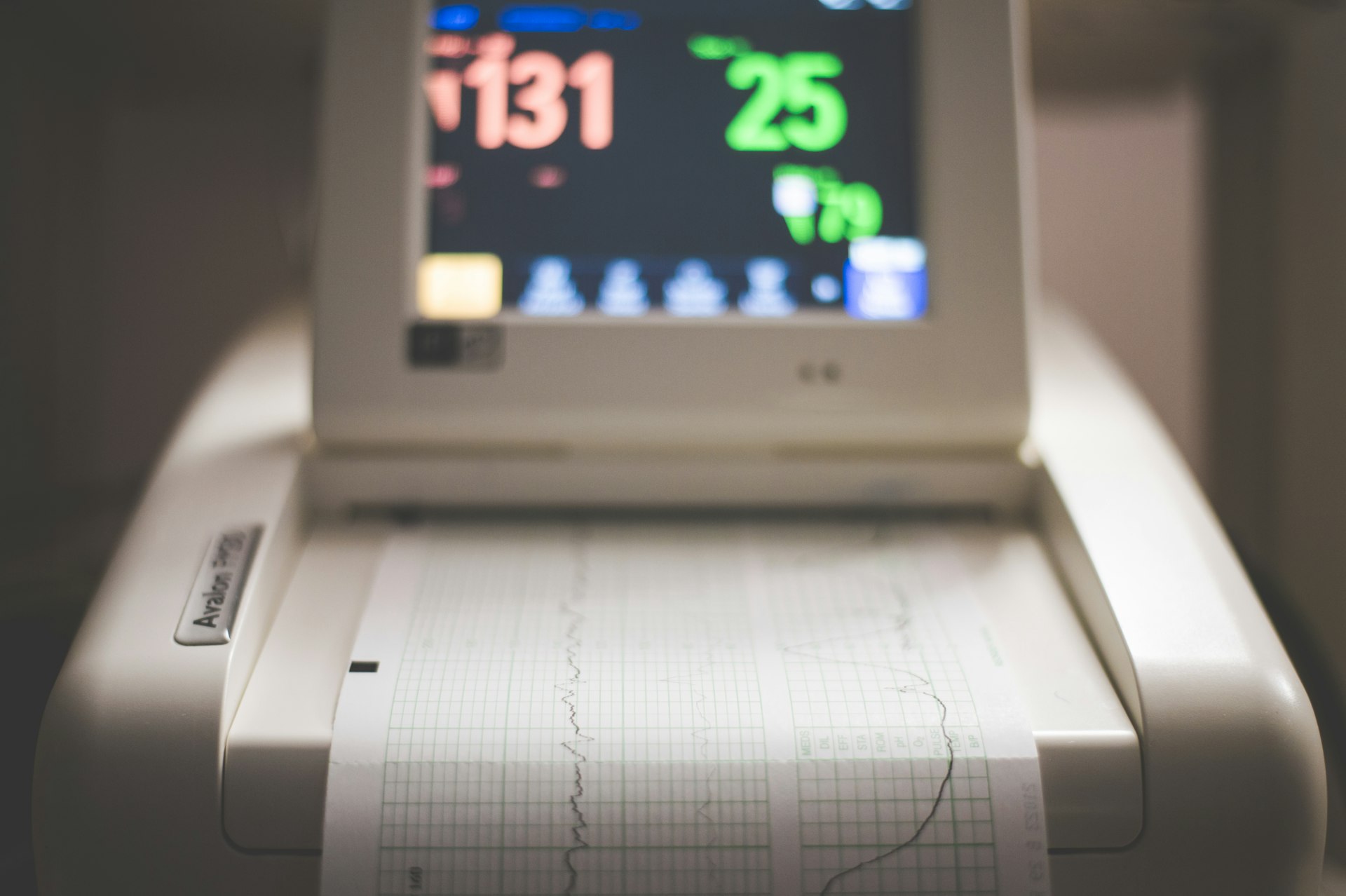 Transforming Athletic Performance: The Impact of Wearable Heart Rate Monitors in Sports